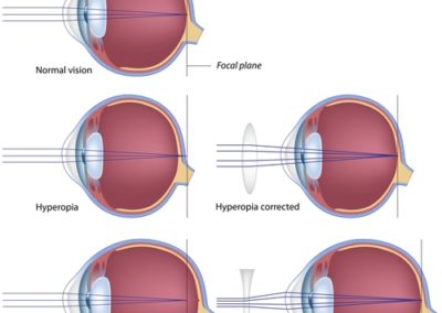 Eye Gallery - Mr Shahram Kashani